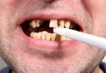 Виды болезней зубов с описанием характерных симптомов, причины возникновения проблем и особенности лечения