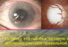 Predstavitev za odprto lekcijo na temo: »Motnje hidrodinamike očesa